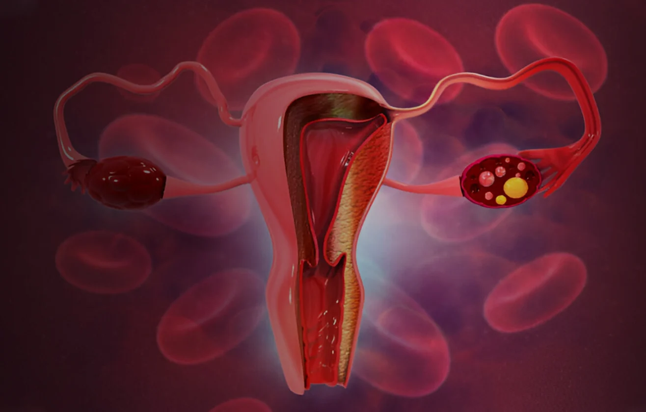 Ovulation-Induction
